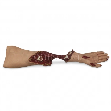 Модель критично травмованої руки