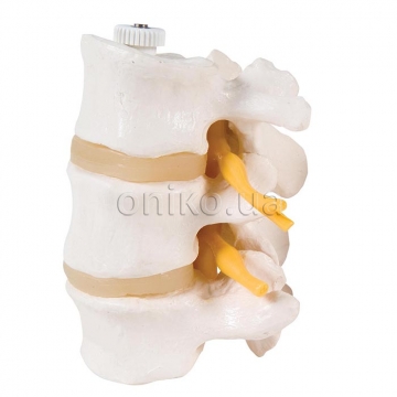 3 Human Lumbar Vertebrae, Flexibly Mounted