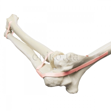 Orthopedics